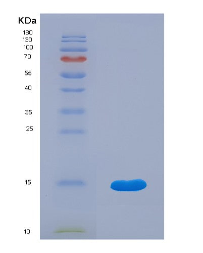 SDS-PAGE analysis of Human EPGN (Epigen) - Recombinant Protein, showing >95% purity under 15% SDS-PAGE (Reduced)