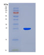 SDS-PAGE analysis of Human ANGPTL8 (Angiopoietin-Like Protein 8) - Recombinant Protein, showing >85% purity under 15% SDS-PAGE (Reduced)