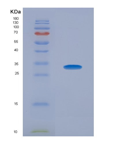 SDS-PAGE analysis of Human IL34 (Interleukin-34) - Recombinant Protein, showing >95% purity under 15% SDS-PAGE (Reduced)