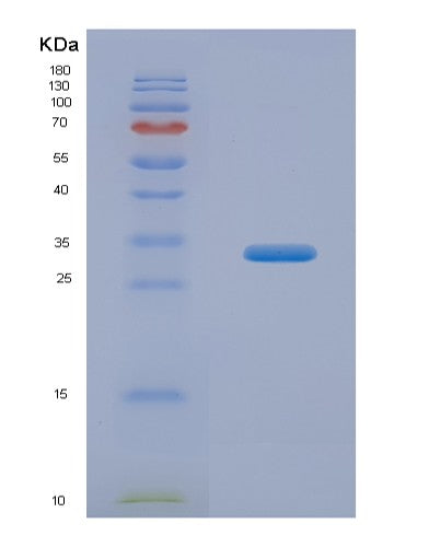 SDS-PAGE analysis of Human TP53 (Cellular Tumor Antigen P53) - Recombinant Protein, showing >90% purity under 15% SDS-PAGE (Reduced)