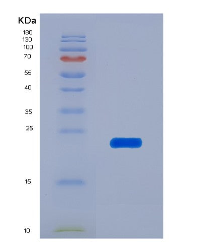 SDS-PAGE analysis of Human AFM (Afamin) - Recombinant Protein, showing >90% purity under 15% SDS-PAGE (Reduced)