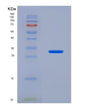 SDS-PAGE analysis of Human DCXR (L-Xylulose Reductase) - Recombinant Protein, showing >95% purity under 15% SDS-PAGE (Reduced)
