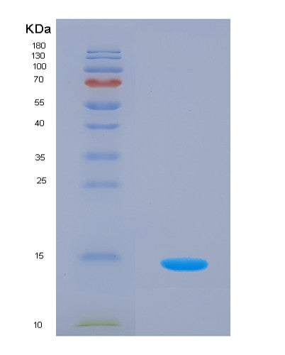 SDS-PAGE analysis of Human VTCN1 (V-Set Domain-Containing T-Cell Activation Inhibitor 1) - Recombinant Protein, showing >85% purity under 15% SDS-PAGE (Reduced)