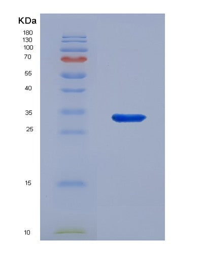 SDS-PAGE analysis of Human TICAM2 (Tir Domain-Containing Adapter Molecule 2) - Recombinant Protein, showing >95% purity under 15% SDS-PAGE (Reduced)