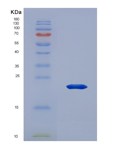 SDS-PAGE analysis of Human PDPN (Podoplanin) - Recombinant Protein, showing >95% purity under 15% SDS-PAGE (Reduced)