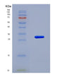 SDS-PAGE analysis of Human Guanine Monophosphate Synthetase (GMPS) - Recombinant Protein, showing >95% purity under 15% SDS-PAGE (Reduced)