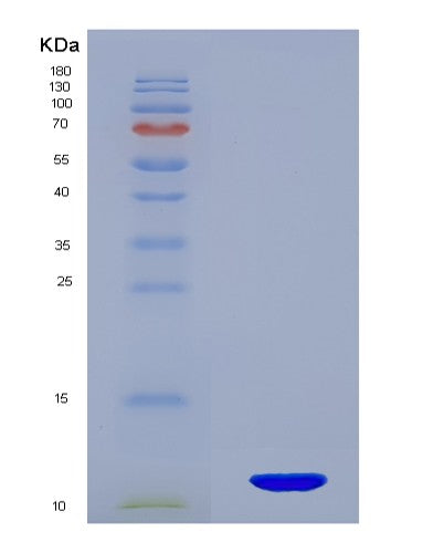 SDS-PAGE analysis of Human SERPINA12 (Serpin A12) - Recombinant Protein, showing >90% purity under 15% SDS-PAGE (Reduced)
