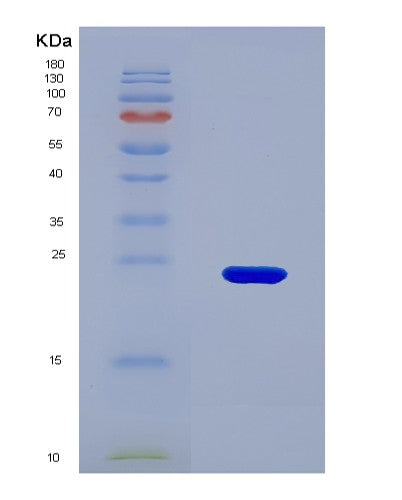 SDS-PAGE analysis of Human TPH2 (Tryptophan 5-Hydroxylase 2) - Recombinant Protein, showing >85% purity under 15% SDS-PAGE (Reduced)