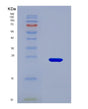 SDS-PAGE analysis of Human TPH2 (Tryptophan 5-Hydroxylase 2) - Recombinant Protein, showing >85% purity under 15% SDS-PAGE (Reduced)