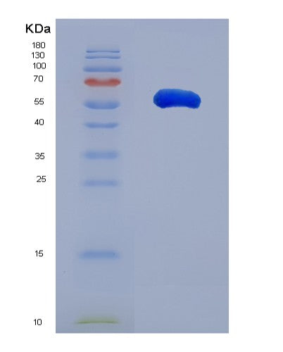SDS-PAGE analysis of Human WWC1 (Protein Kibra) - Recombinant Protein, showing >85% purity under 15% SDS-PAGE (Reduced)