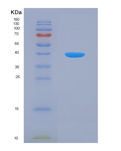 SDS-PAGE analysis of Mouse Lgals4 (Galectin-4) - Recombinant Protein, showing >95% purity under 15% SDS-PAGE (Reduced)