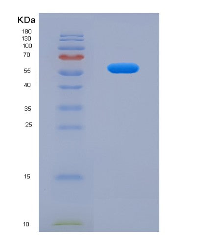 SDS-PAGE analysis of Human GOLM1 (Golgi Membrane Protein 1) - Recombinant Protein, showing >90% purity under 15% SDS-PAGE (Reduced)