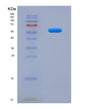 SDS-PAGE analysis of Human GOLM1 (Golgi Membrane Protein 1) - Recombinant Protein, showing >90% purity under 15% SDS-PAGE (Reduced)