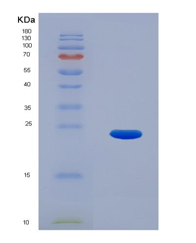 SDS-PAGE analysis of Human TRPV1 (Transient Receptor Potential Cation Channel Subfamily V Member 1) - Recombinant Protein, showing >95% purity under 15% SDS-PAGE (Reduced)