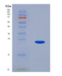 SDS-PAGE analysis of Human TRPV1 (Transient Receptor Potential Cation Channel Subfamily V Member 1) - Recombinant Protein, showing >95% purity under 15% SDS-PAGE (Reduced)
