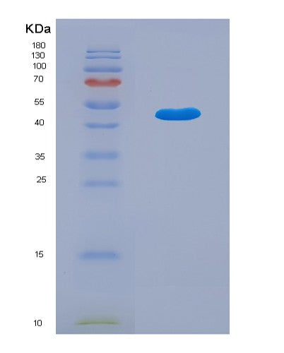 SDS-PAGE analysis of Human LPCAT1 (Lysophosphatidylcholine Acyltransferase 1) - Recombinant Protein, showing >95% purity under 15% SDS-PAGE (Reduced)
