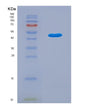 SDS-PAGE analysis of Human LPCAT1 (Lysophosphatidylcholine Acyltransferase 1) - Recombinant Protein, showing >95% purity under 15% SDS-PAGE (Reduced)