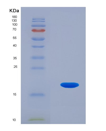 SDS-PAGE analysis of Human PFN4 (Profilin-4) - Recombinant Protein, showing >90% purity under 15% SDS-PAGE (Reduced)