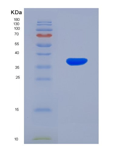 SDS-PAGE analysis of Human CCL4L1 (C-C Motif Chemokine 4-Like) - Recombinant Protein, showing >90% purity under 15% SDS-PAGE (Reduced)