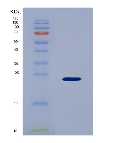 SDS-PAGE analysis of Mouse Blmh (Bleomycin Hydrolase) - Recombinant Protein, showing >95% purity under 15% SDS-PAGE (Reduced)