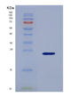 SDS-PAGE analysis of Mouse Blmh (Bleomycin Hydrolase) - Recombinant Protein, showing >95% purity under 15% SDS-PAGE (Reduced)