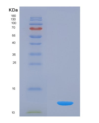 SDS-PAGE analysis of Human GPT2 (Alanine Aminotransferase 2) - Recombinant Protein, showing >95% purity under 15% SDS-PAGE (Reduced)
