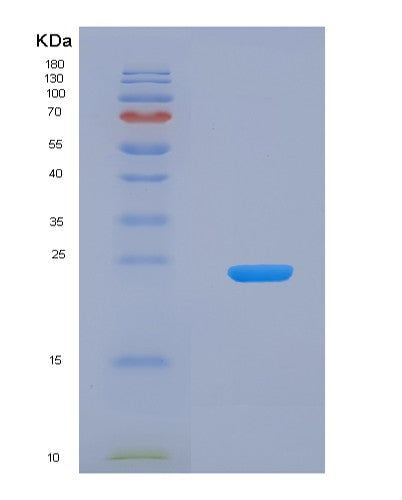 SDS-PAGE analysis of Human HAVCR2 (Hepatitis A Virus Cellular Receptor 2) - Recombinant Protein, showing >90% purity under 15% SDS-PAGE (Reduced)