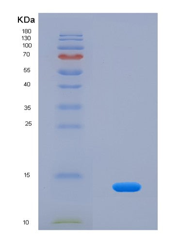 SDS-PAGE analysis of Human DEFB104A (Beta-Defensin 104) - Recombinant Protein, showing >95% purity under 15% SDS-PAGE (Reduced)