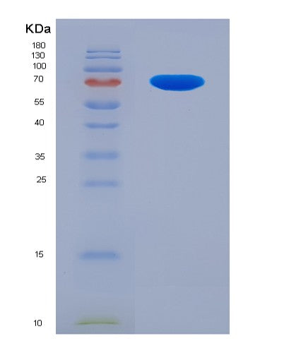SDS-PAGE analysis of Human USP9X (Ubiquitin Carboxyl-Terminal Hydrolase 9X) - Recombinant Protein, showing >90% purity under 15% SDS-PAGE (Reduced)