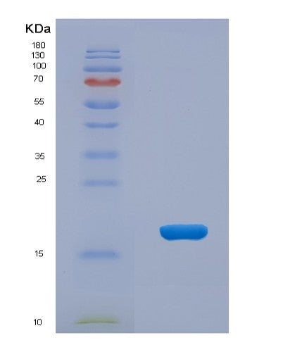 SDS-PAGE analysis of Human PTPMT1 (Phosphatidylglycerophosphatase And Protein-Tyrosine Phosphatase 1) - Recombinant Protein, showing >95% purity under 15% SDS-PAGE (Reduced)