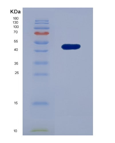 SDS-PAGE analysis of Human PDCD6IP (Programmed Cell Death 6-Interacting Protein) - Recombinant Protein, showing >90% purity under 15% SDS-PAGE (Reduced)