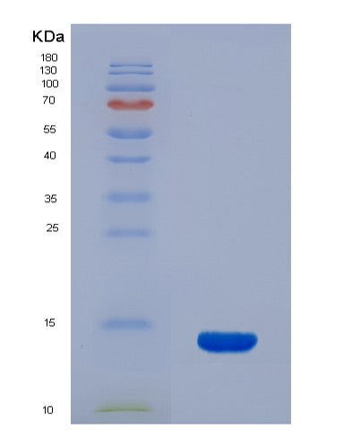 SDS-PAGE analysis of Human SLC1A1 (Excitatory Amino Acid Transporter 3) - Recombinant Protein, showing >90% purity under 15% SDS-PAGE (Reduced)