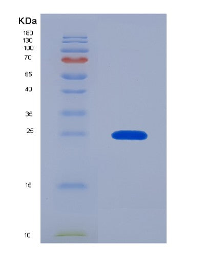 SDS-PAGE analysis of Human CYGB (Cytoglobin) - Recombinant Protein, showing >95% purity under 15% SDS-PAGE (Reduced)
