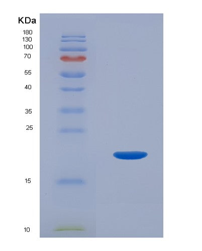 SDS-PAGE analysis of Human IL1F10 (Interleukin-1 Family Member 10) - Recombinant Protein, showing >95% purity under 15% SDS-PAGE (Reduced)
