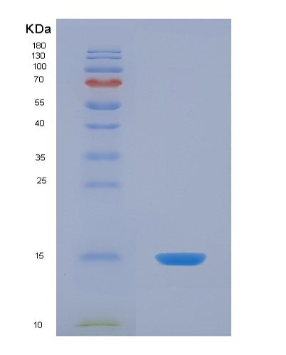 SDS-PAGE analysis of Human S100Z (Protein S100-Z) - Recombinant Protein, showing >90% purity under 15% SDS-PAGE (Reduced)