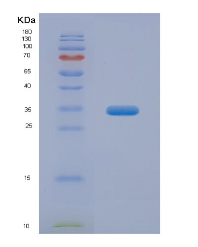 SDS-PAGE analysis of Mouse Adipor1 (Adiponectin Receptor Protein 1) - Recombinant Protein, showing >95% purity under 15% SDS-PAGE (Reduced)