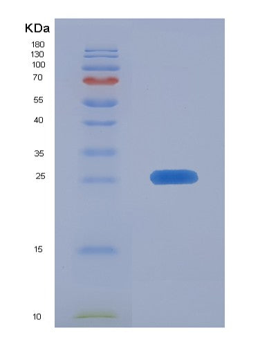 SDS-PAGE analysis of Human FAM3C (Protein Fam3C) - Recombinant Protein, showing >95% purity under 15% SDS-PAGE (Reduced)