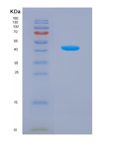 SDS-PAGE analysis of Human SLC2A4 (Solute Carrier Family 2, Facilitated Glucose Transporter Member 4) - Recombinant Protein, showing >90% purity under 15% SDS-PAGE (Reduced)
