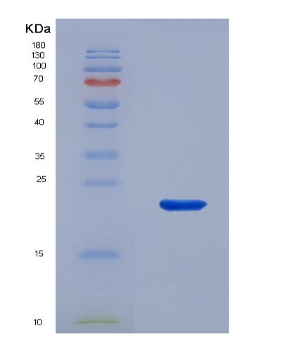 SDS-PAGE analysis of Human THRSP (Thyroid Hormone-Inducible Hepatic Protein) - Recombinant Protein, showing >95% purity under 15% SDS-PAGE (Reduced)