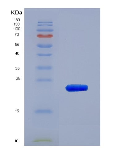 SDS-PAGE analysis of Human BCL2L2 (Bcl-2-Like Protein 2) - Recombinant Protein, showing >90% purity under 15% SDS-PAGE (Reduced)