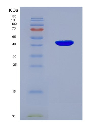 SDS-PAGE analysis of Human GPX4 (Phospholipid Hydroperoxide Glutathione Peroxidase Gpx4) - Recombinant Protein, showing >90% purity under 15% SDS-PAGE (Reduced)