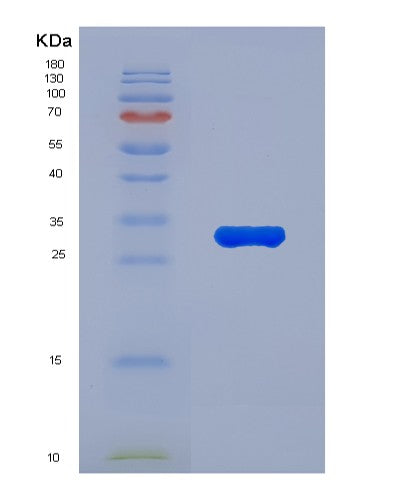 SDS-PAGE analysis of Human CASP10 (Caspase-10) - Recombinant Protein, showing >85% purity under 15% SDS-PAGE (Reduced)