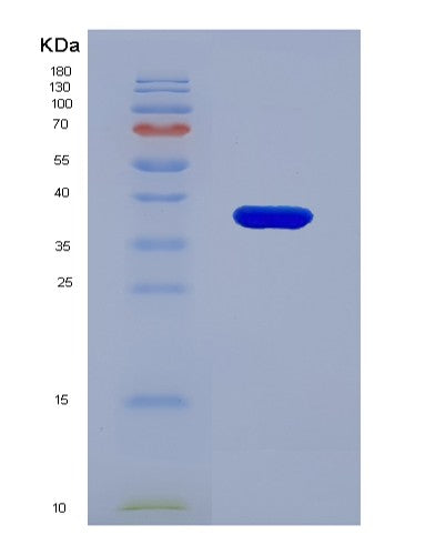 SDS-PAGE analysis of Human PMM1 (Phosphomannomutase 1) - Recombinant Protein, showing >95% purity under 15% SDS-PAGE (Reduced)