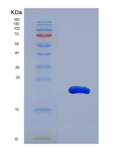 SDS-PAGE analysis of Human GCDH (Glutaryl-Coa Dehydrogenase, Mitochondrial) - Recombinant Protein, showing >95% purity under 15% SDS-PAGE (Reduced)