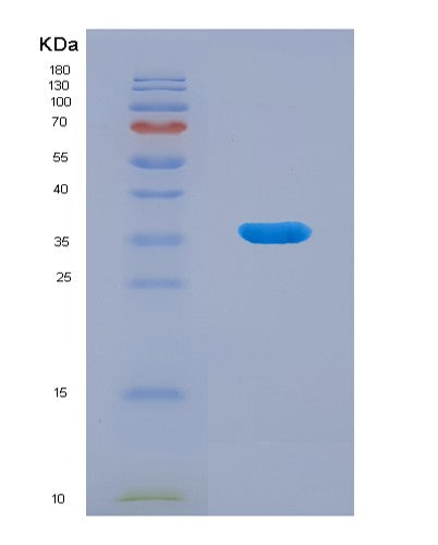 SDS-PAGE analysis of Human BHMT (Betaine--Homocysteine S-Methyltransferase 1) - Recombinant Protein, showing >90% purity under 15% SDS-PAGE (Reduced)