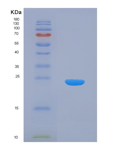 SDS-PAGE analysis of Human PTP4A1 (Protein Tyrosine Phosphatase Type Iva 1) - Recombinant Protein, showing >90% purity under 15% SDS-PAGE (Reduced)