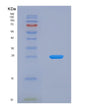 SDS-PAGE analysis of Human CSN2 (Beta-Casein) - Recombinant Protein, showing >95% purity under 15% SDS-PAGE (Reduced)