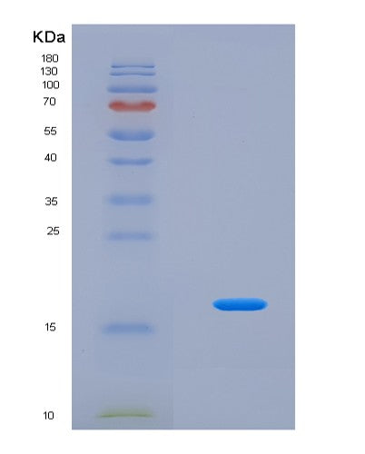 SDS-PAGE analysis of Human TSLP (Thymic Stromal Lymphopoietin) - Recombinant Protein, showing >95% purity under 15% SDS-PAGE (Reduced)