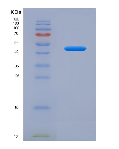 SDS-PAGE analysis of Human RFK (Riboflavin Kinase) - Recombinant Protein, showing >85% purity under 15% SDS-PAGE (Reduced)