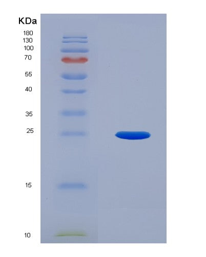 SDS-PAGE analysis of Human UBE2F (Nedd8-Conjugating Enzyme Ube2F) - Recombinant Protein, showing >90% purity under 15% SDS-PAGE (Reduced)